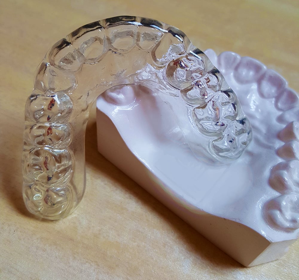 friendship-dental-lab-nightguards-on-model