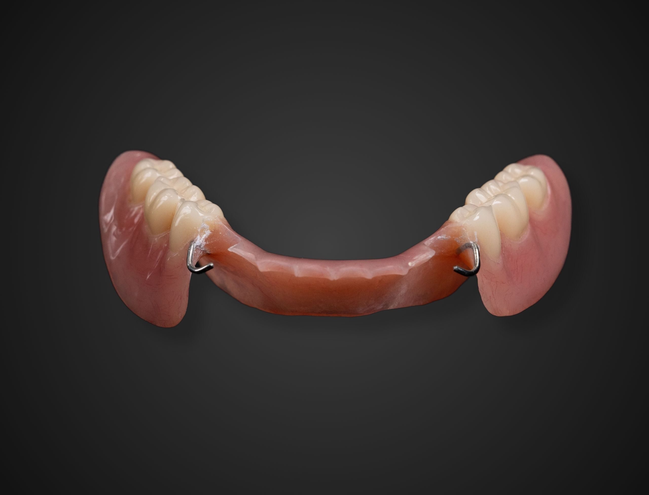 friendship-dental-lab acrylic-partials