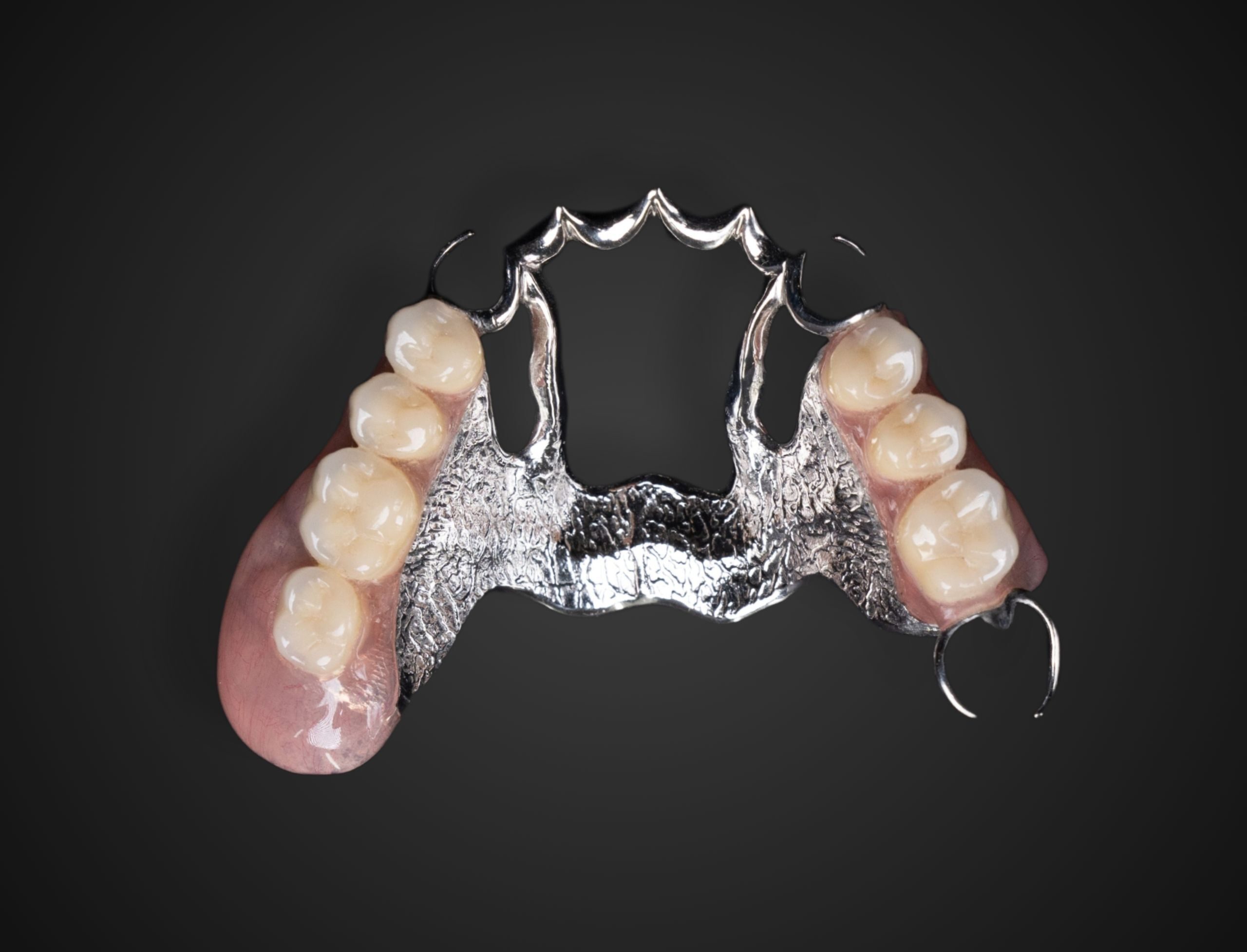 friendship-dental-lab-cast-partial