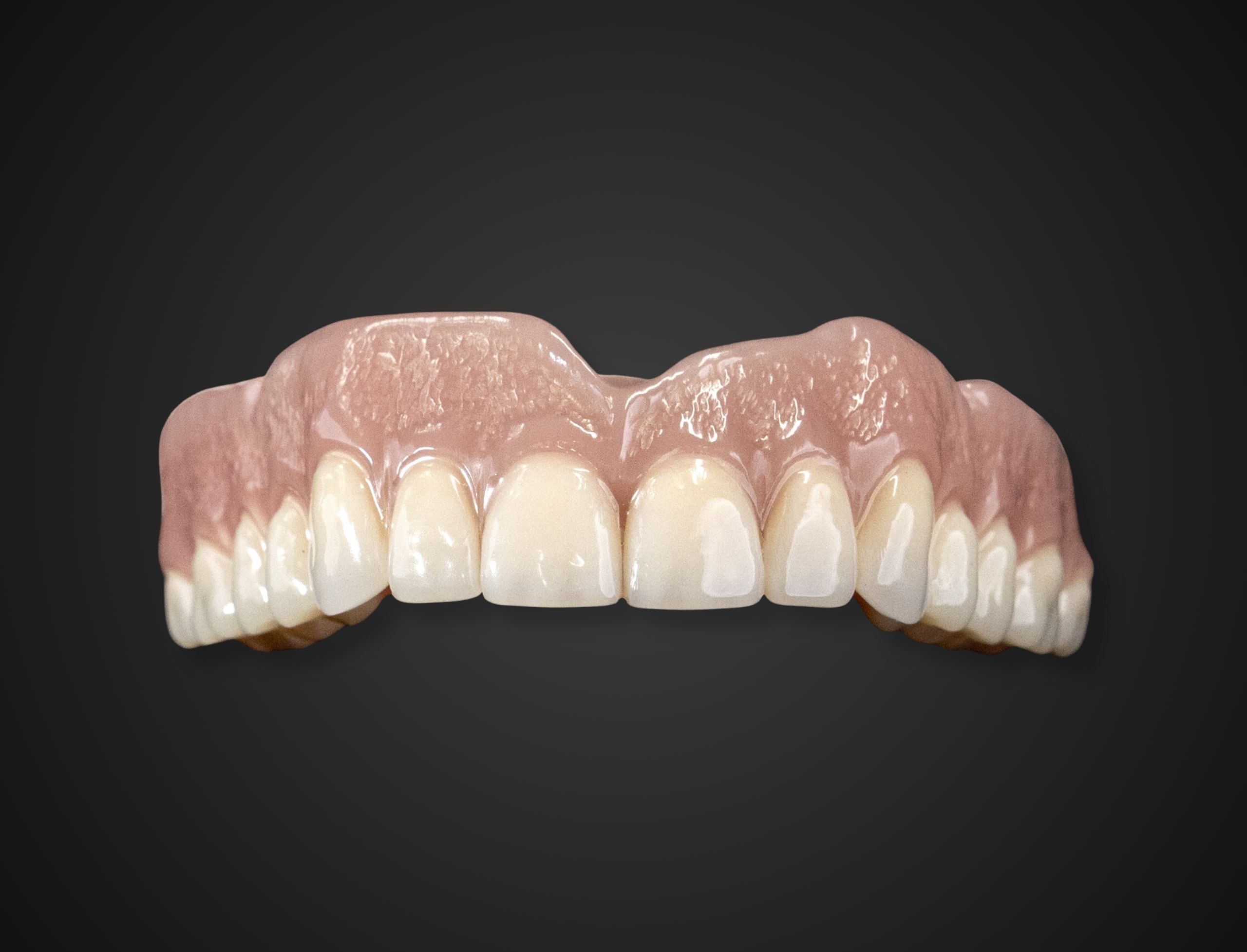 friendship-dental-lab-conventional-denture