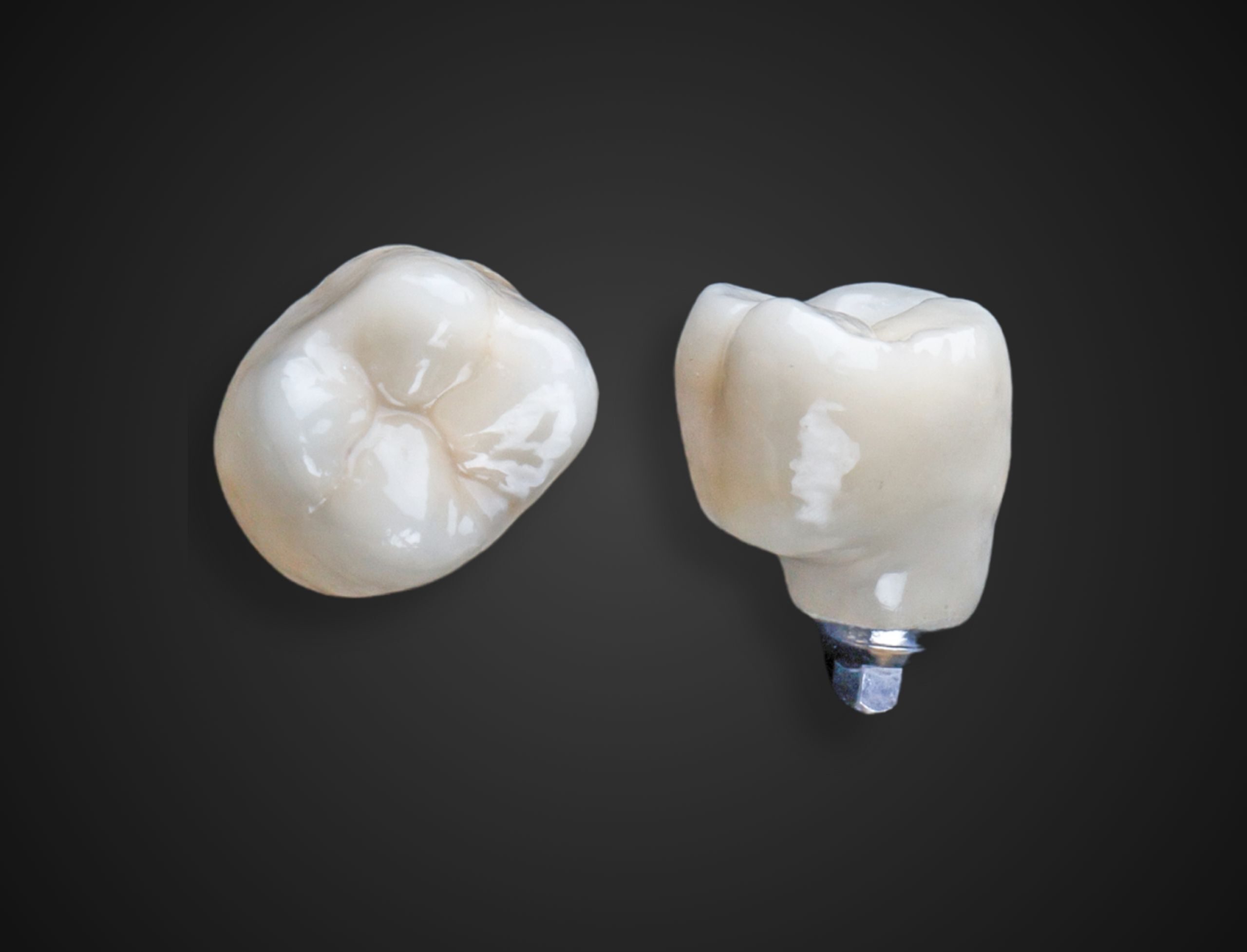 implant-cementable-qh3xpr5m9juohbfb7zhsjs61vkpg8py32pjnpz282c
