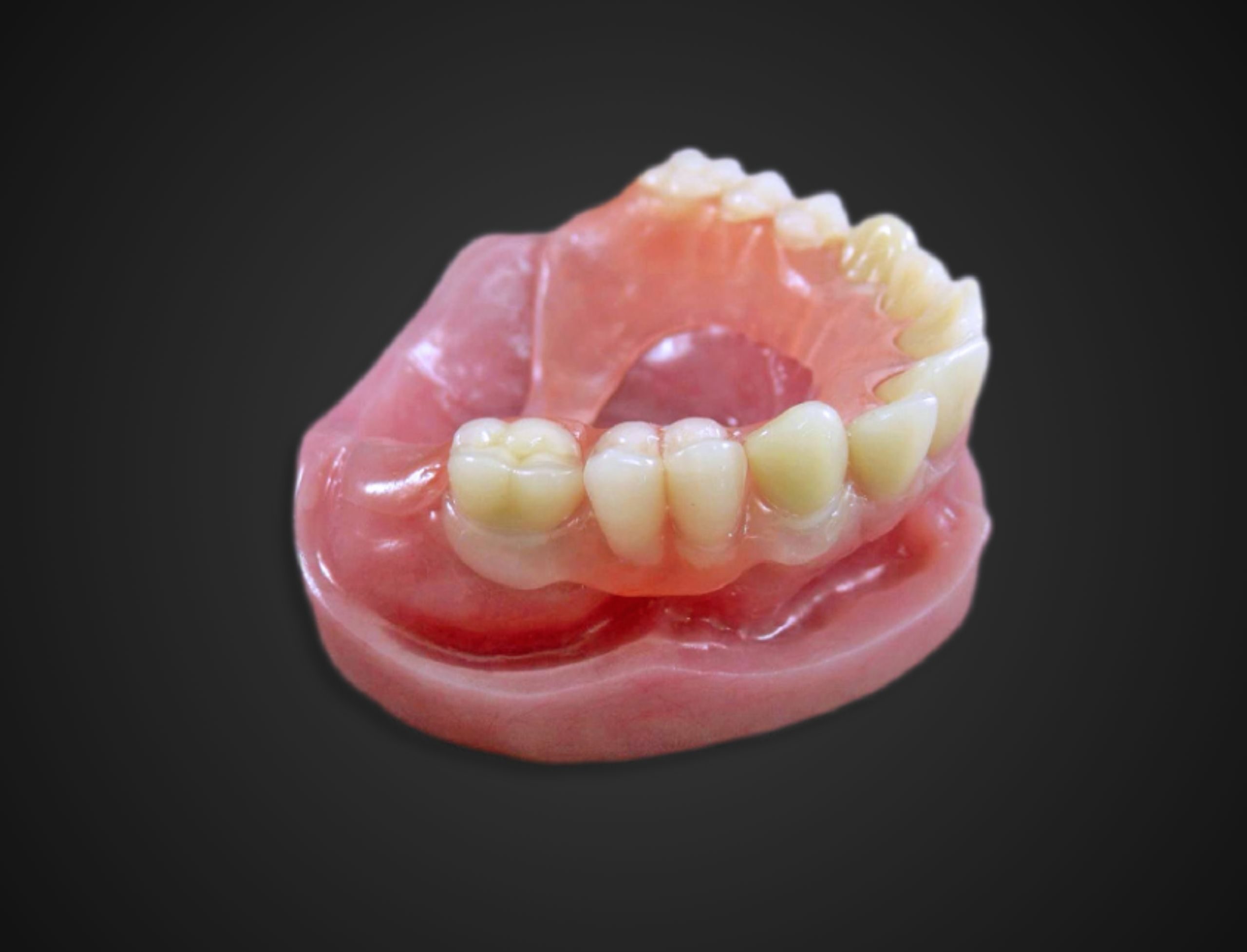 friendship-dental-lab-flexible-partial